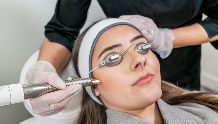 تعمیر دستگاه لیزر کیوسوئیچینگ Q-switching laser - تعمیرات پزشکی آساره