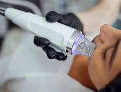 تعمیر دستگاه RF فرکشنال - تعمیرات پزشکی آساره