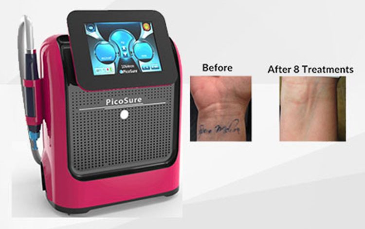 تعمیر دستگاه لیزر پیکوشور - تعمیرات پزشکی آساره