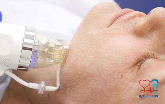 مراقبت بعد از تعمیر دستگاه های RF و فیشیال