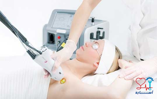 عیب یابی دستگاه لیزر موی زائد