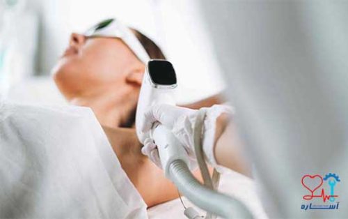 سرویس دستگاه لیزر