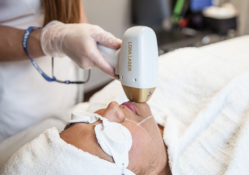 تعمیر دستگاه لیزر موهای زائد